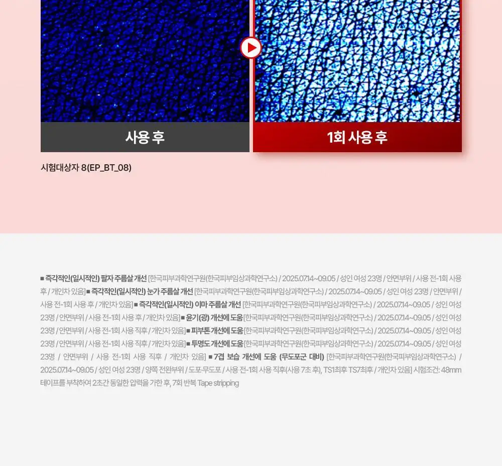 [기미잡티] 메디필 멜라논엑스 앰플 RX 30ml 상세페이지 19